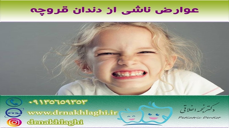 متخصص دندانپزشکی کودکان عوارض براکسیسم یا دندان قروچه