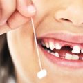 دندان های شیری و مراحل رویش و تکامل | دندانپزشک کودکان اصفهان