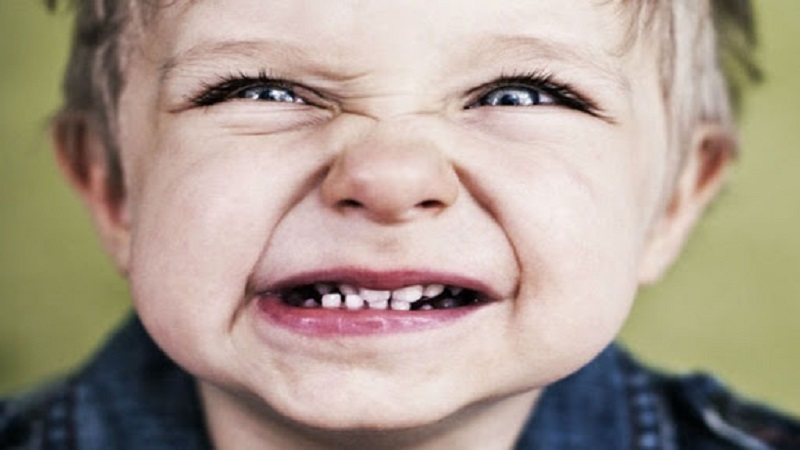 دندان قروچه، براکسیسم یا سایش دندانی | دندانپزشک کودکان اصفهان